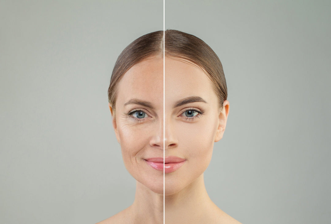 The Secret to Supple Skin: How At-Home HIFU Maximizes Benefits